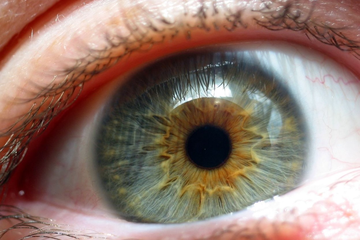 Close-up photo of a person's face in natural daylight, showing hazel eyes with flecks of green and gold around a brown center.